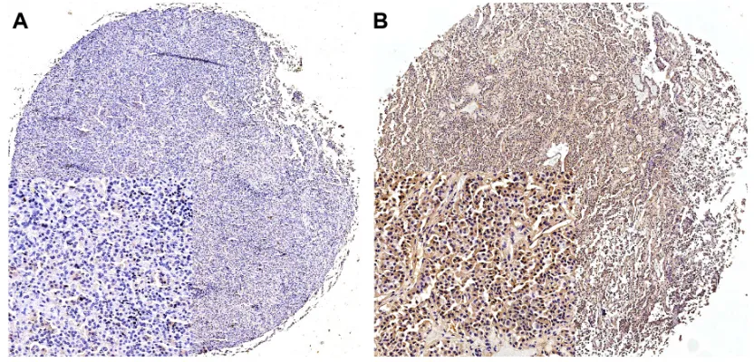 Figure 4 Ki-67 expression in nFPas.