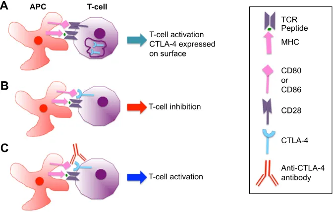 Figure 1 T-cell activation by anti-CTLA-4 antibodies.Notes: (A) Tumor antigens can be presented to specific T-cells by APCs, leading to the T-cell activation and the immune response against the tumor