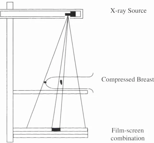 Figure 1: traditional mammography involves obtaining a planar X- ray of the compressed breast