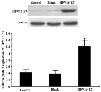 Figure 1. HPV6 E7 protein expression. A. Western blotting bands of HPV16 E7 protein; B