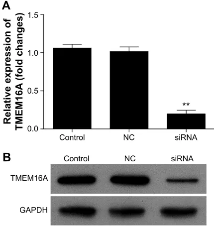 Figure 2 expression of TMeM16a in sMMc-7721 cells after TMeM16a sirna transfection.Notes: (A) qrT-Pcr analyzed the mrna expression of TMeM16a in sMMc-7721 cells after TMeM16a-sirna transfection