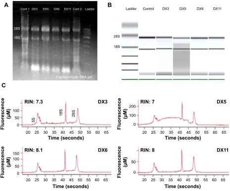 Figure 1 Total rna quality control.Notes: (A) The total rna sample is shown as 18s and 28s bands by electrophoresis on a 1% formaldehyde gel