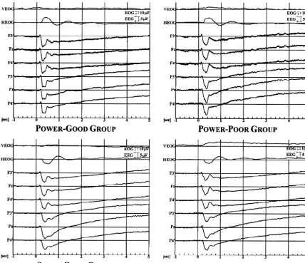 Fig. 2. Event-related SCP waveforms at parietal and fronto-medial leads of good and poor performers processing a visuo-spatial imagery task with(bottom) and without (top) the instruction to respond as quickly and accurately as possible
