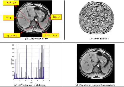 Fig. 2.  LBP Operation 