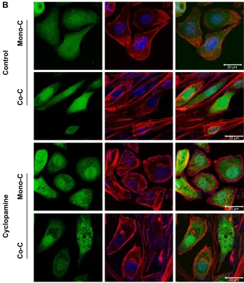 Figure 3 Inhibition of hedgehog signaling affects the EMT phenotype through remodeling of the actin cytoskeleton