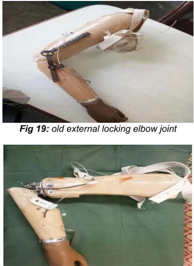 Fig 19: old external locking elbow joint  