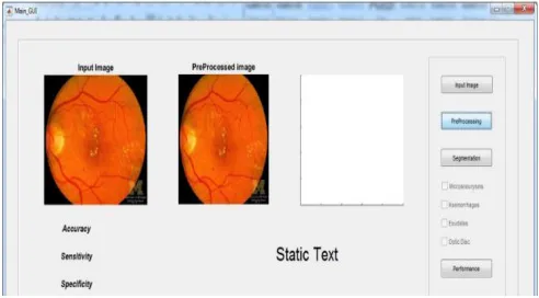 Fig. 4. Screenshot of captured preprocessed image  