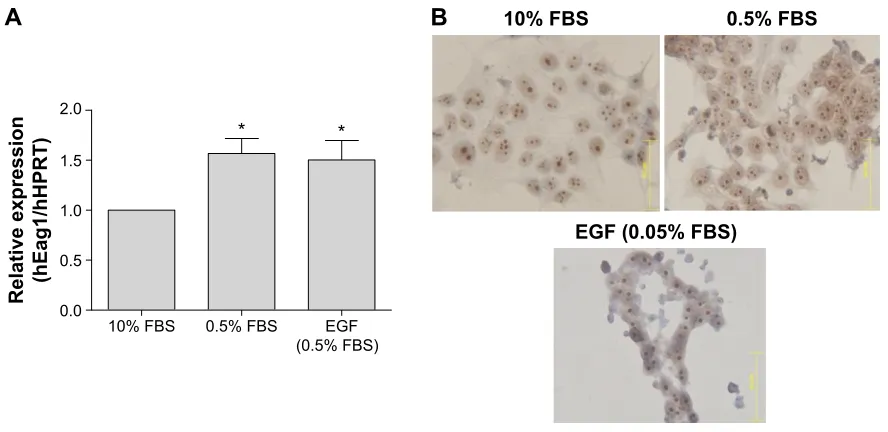 Figure 3 serum deprivation up-regulates ether à-go-go-1 (eag1) expression in breast cancer cells.Notes: eag1 mrna expression increased as the serum concentration decreased (A)