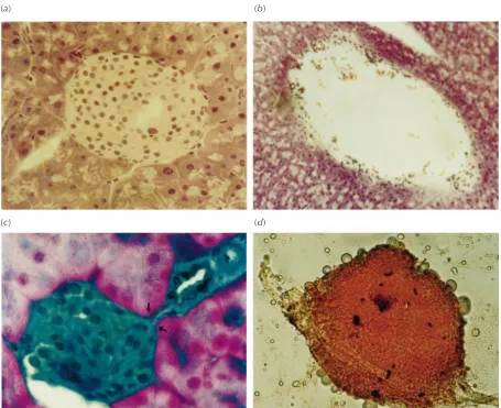Figure 3 Pancreas from BALB/c mice of: (a) CS group, HE stained and (b) DS group, HE stained