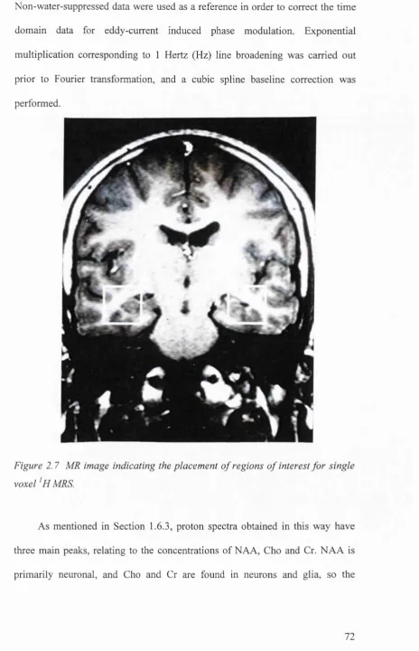 Figure 2.7 MR image indicating the placem ent o f regions o f interest fo r single 