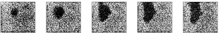 Figure 1. Spontaneous wave in the ferret retina. Each of the frames shows approximately 1 mm2of ferret retina using calcium concentration imaging, a measure of the activity of the retinal cells.Dark areas indicate increased activity
