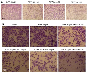 Figure 2 H1975 cell migration was inhibited by BEZ235.Notes: h1975 cells were seeded in 24-well plates and incubated with different concentrations of drugs