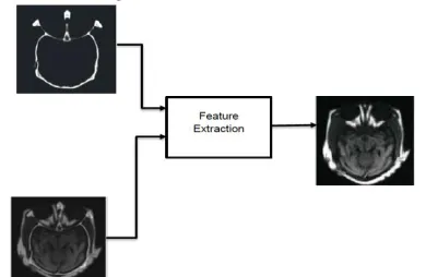 Figure 2: (A) MRI image (B) CT image (C) DWT fusion  results 