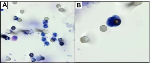Figure 1 (A) Blood from a healthy subject: only residual leukocytes are visible, without any cTcs visualized on the iseT membrane