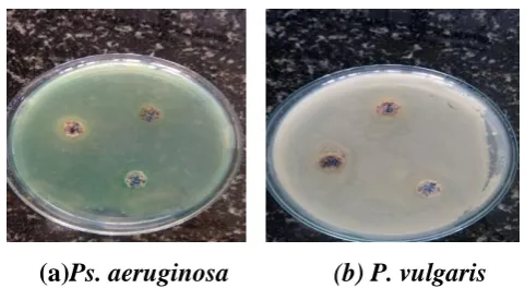 Figure 5: Antimicrobial activity of flaxseed   paste and distilled water (E) against test pathogenic microorganisms