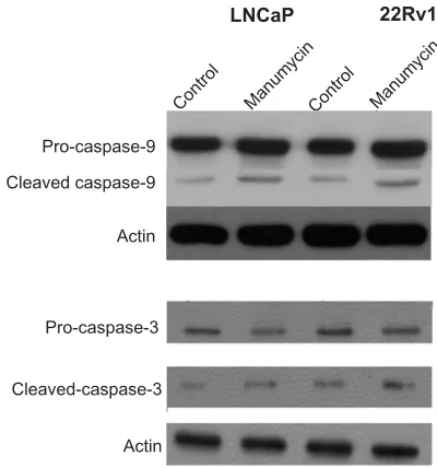 Figure 1 cytotoxic effect of manumycin against lncaP and 22rv1 prostate cancer 