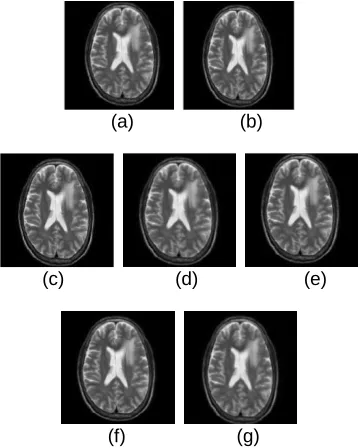 Fig. 5: Sampling rates versus PSNR Comparison  for different CS algorithms  