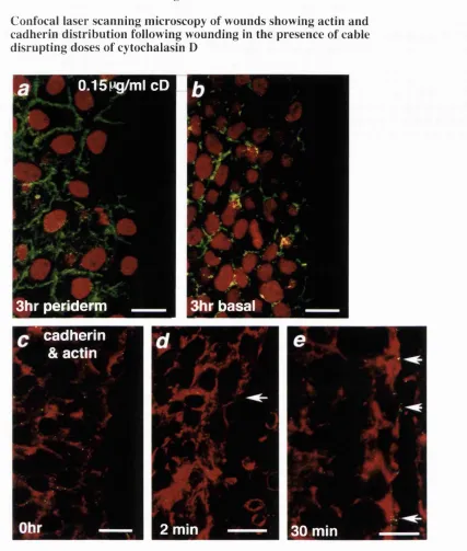 Fig 9Confocal laser scanning microscopy of wounds showing actin and 
