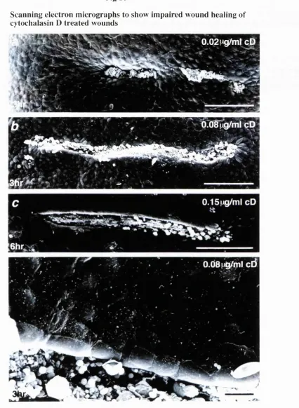 Fig 10Scanning electron m icrographs to show im paired wound healing of 