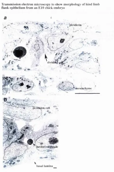 Fig 16Transmission electron microscopy to show morphology of hind limb
