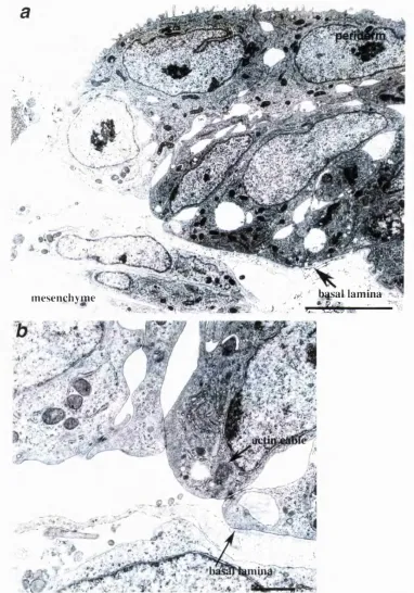 Fig 17Transmission electron microscopy to show detailed morphology of