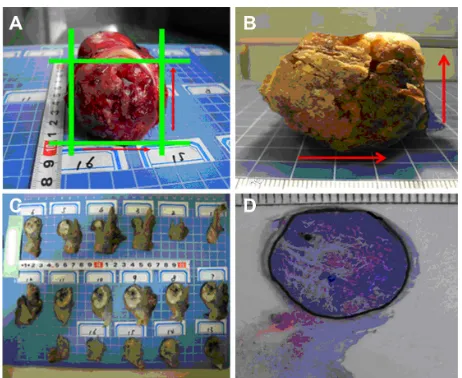 Figure 1 (A–D) Pathology procedure. The specimens are collected from surgery (A) and fixed in 10% formalin (B)