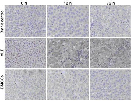 Figure 2. HMGB1 protein expression in the liver of different groups (super vision two step immunohistochemistry; ×400).