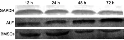 Figure 3. HMGB1 protein expression in the liver (Western blot assay).