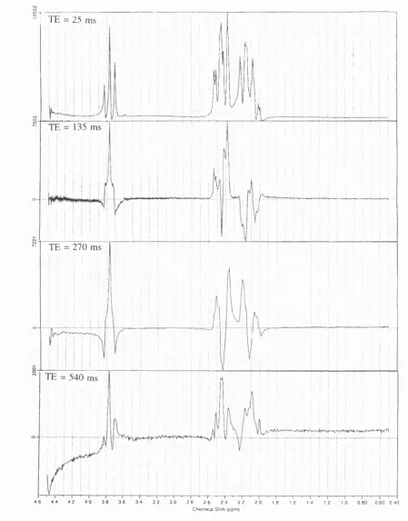 Figure 6.10. Gin model spectra acquired using PRESS localisation
