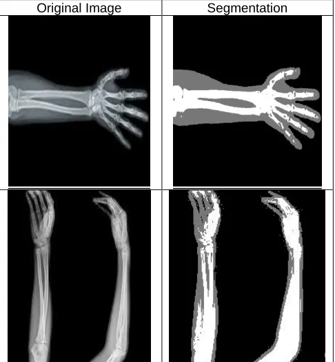 Fig. 3. Image segmentation using ATC segmentation algorithm   