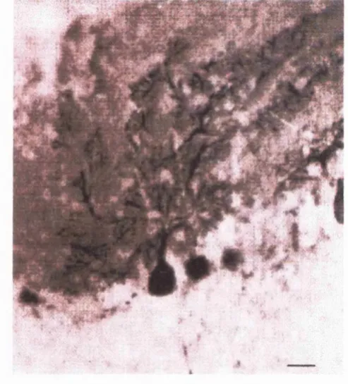 Figure 1-3 Purkinje cells labelled with anti-calbindin antibodies