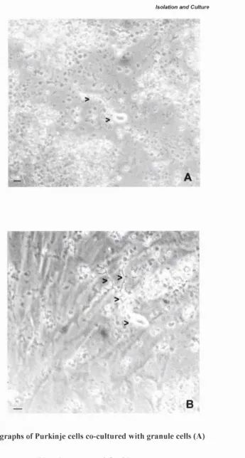 Figure 11-10 Photographs of Purkinje cells co-cultured with granule cells (A) or glial cells (B).