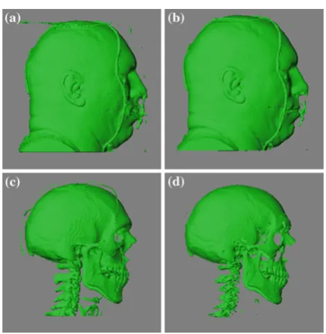 Fig. 2 Volume rendering of a male head dataset using marching cubeswith different isovalues: a 30, b 50, c 75, d 100