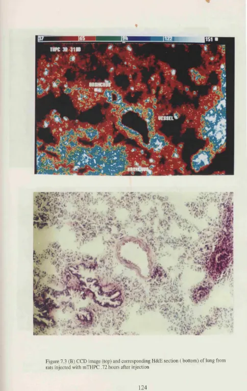 Figure 7.3 (B) CCD image (top) and corresponding H&E section ( bottom) of lung from 