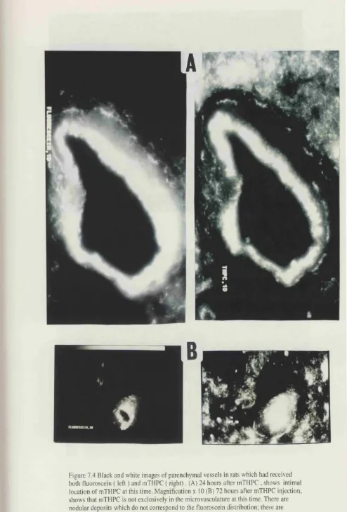 Figure 7.4 Black and white images of parenchyma! vessels in rats which had received both fluoroscein ( left ) and mTHPC ( right)