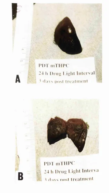 Figure 8.6 Vascular effects of PDT with mTHPC with 24 hour drug light interval, light dose 80 J.(A) Whole lung (B) Cut surface perpendicular to line of laser fibre insertion.
