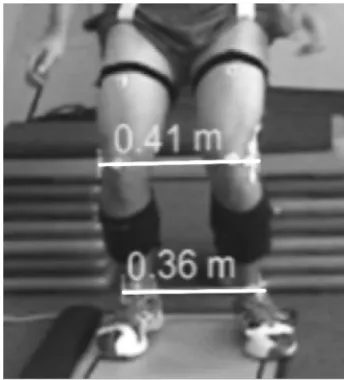 Figure 3 KSD quantified as the distance (in meters) between the right and left lateral femoral epicondyle markers between initial contact phase (A) and peak knee flexion (B).Abbreviation: KSD, knee separation distance.