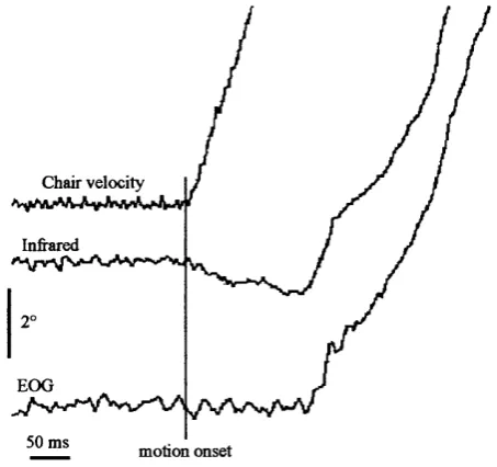 Fig. 2-4: Infrared and EOG recordings obtained in a patient without vestibular function during translational lateral acceleration of 0.2g and ocular fixation on a 60 cm-distant earth-fixed target Artifact starting at motion onset and lasting about 150 ms can be observed on the infrared signal