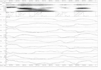 Figure 9.2a: Frame-by-frame values (solid lines) superim posed on calculated m odel values (dottedlines) according to standard H M M  modelling assumptions