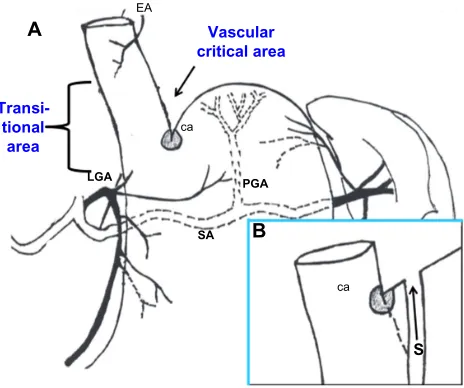 Figure 1 Gastric fundus vascularization.Notes: (A) vascular transitional area (critical area)