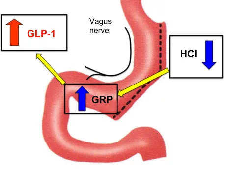 Figure 3 The “gastric hypothesis.”