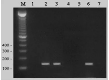 Figure 1: Agarose gel showing specific bands of H. pylori ure C gene PCR products in lane 2,3 & 6