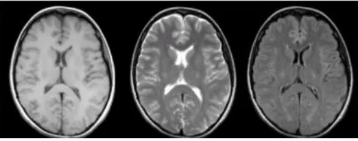 Fig.1 show different MRI sequences.  
