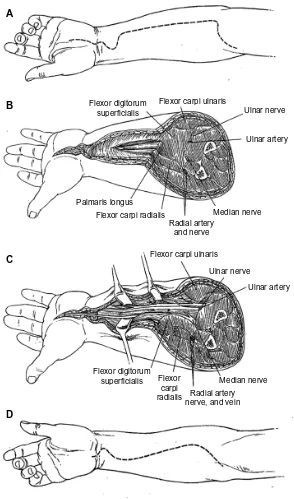 Figure 4 Surgical approaches to the volar compartment of the forearm.and commercial use of the material in print, digital or mobile device format is prohibited without the permission from the publisher wolters Kluwer Health