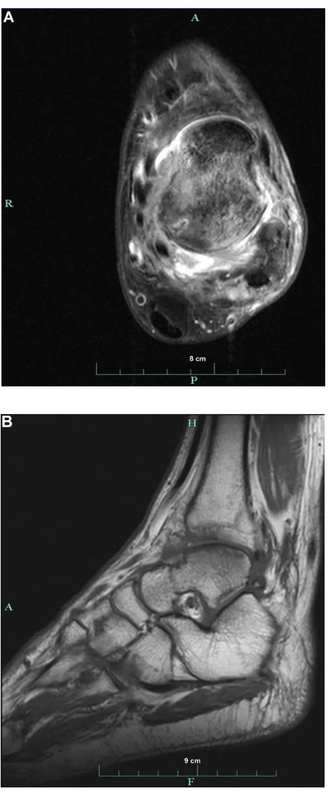 Figure 5 MRI images.
