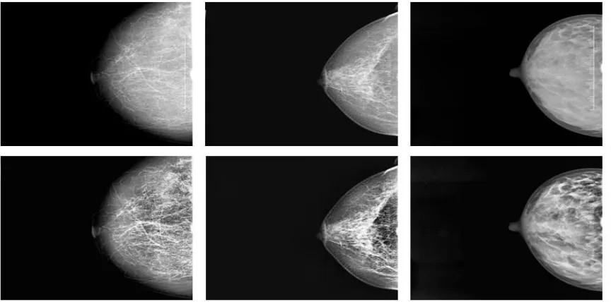 Fig.5 Sample left images segmented results from Jalgaon’s Hospital database.  