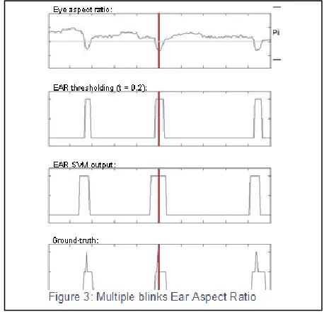 Figure 2:  Eye Blink Sensor 