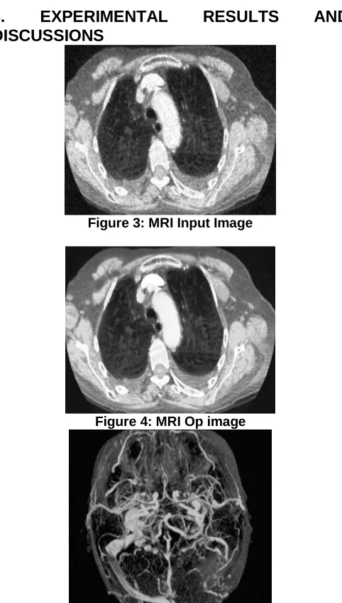 Figure 3: MRI Input Image 