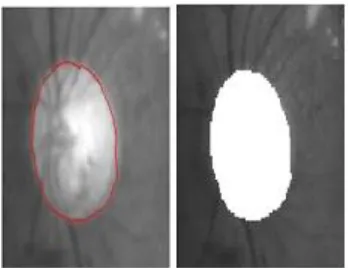 Fig 8. optic disc active    Fig 9. optic disc removed 