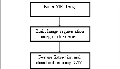 Fig. 1. Brain Tumor Disease Classification Model 